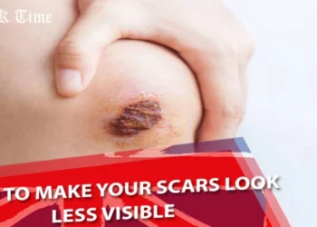 How to Make Your Scars Look Less Visible