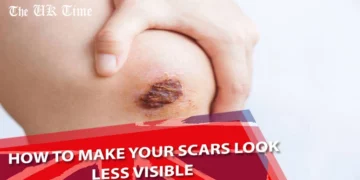 How to Make Your Scars Look Less Visible