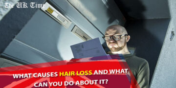 What Causes Hair Loss and What Can You Do About It?
