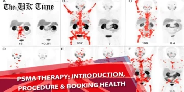 PSMA Therapy